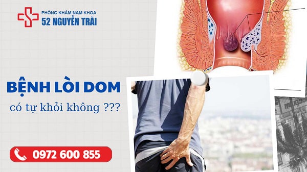 Bệnh lòi dom có tự khỏi được không ?