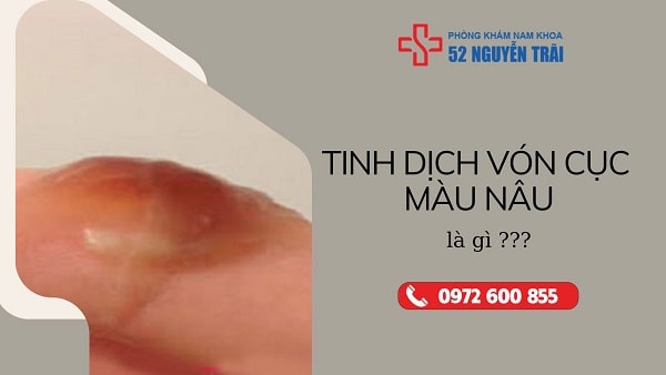 Tinh dịch vón cục màu nâu là gì