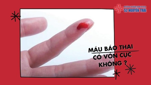 Máu báo thai có vón cục không ?