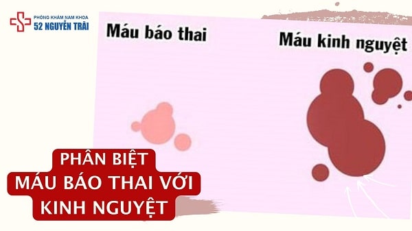 Cách phân biệt máu báo thai với kinh nguyệt