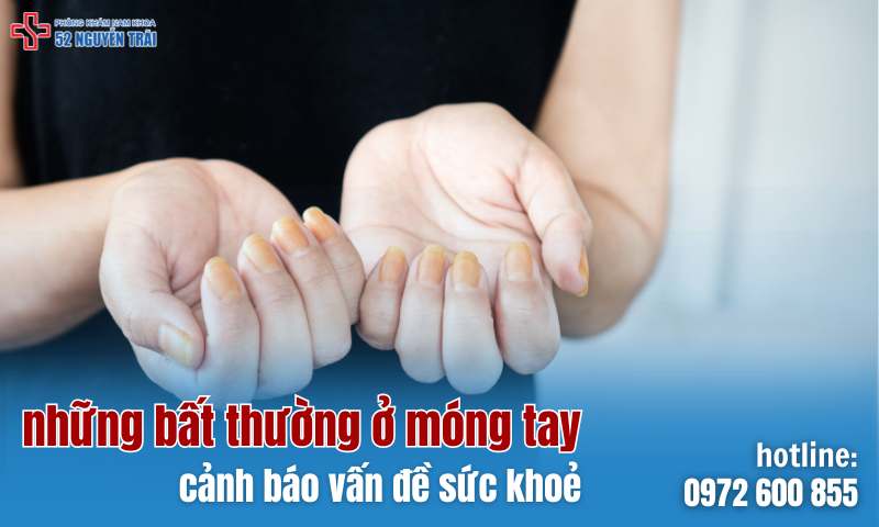 Những dấu hiệu bất thường trên móng tay cảnh báo vấn đề sức khoẻ