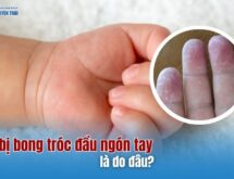 Trẻ bị bong tróc đầu ngón tay là do đâu?