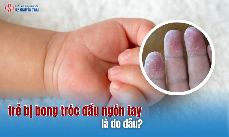 Trẻ bị bong tróc đầu ngón tay là do đâu?