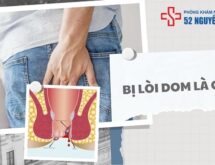 Bị lòi dom là gì ?