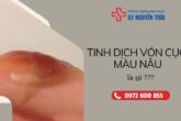 Tinh dịch vón cục màu nâu là gì