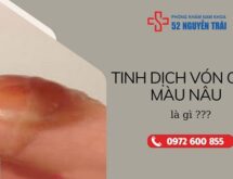 Tinh dịch vón cục màu nâu là gì