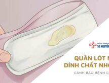 Quần lót nữ dính chất nhờn là bị gì ?