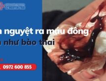 Hiện tượng kinh nguyệt ra máu đông nhìn như bào thai là do đâu ?